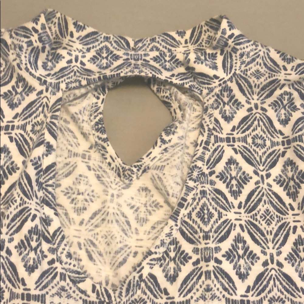 Keyhole Tunic